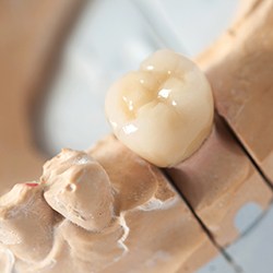 Model tooth with dental crown