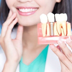 dentist holding model of dental implants in Lisle
