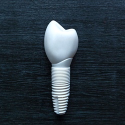 model of how dental implants in Lisle work