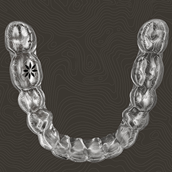 Clear alignment tray