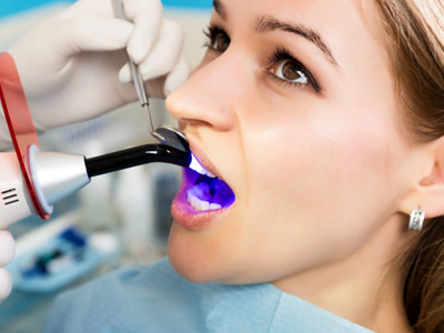 Dentist applying light to harden woman’s filling