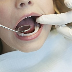 Child receiving dental exam