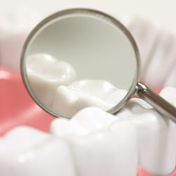 Closeup of teeth after dental sealants