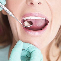 Closeup of patient during dental exam