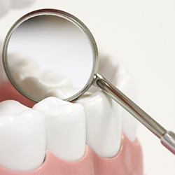 Closeup of teeth with dental sealants