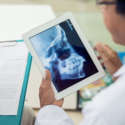 Dentist looking at x-ray of jaw and skull