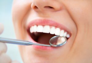 Don’t ignore signs of gum disease. Learn from your Lisle dentists, Drs. Frank Marchese and Dr. Jeanelle Marchese, when a deep cleaning is needed.