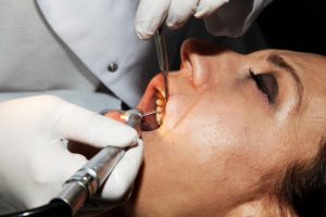 woman during dental checkup