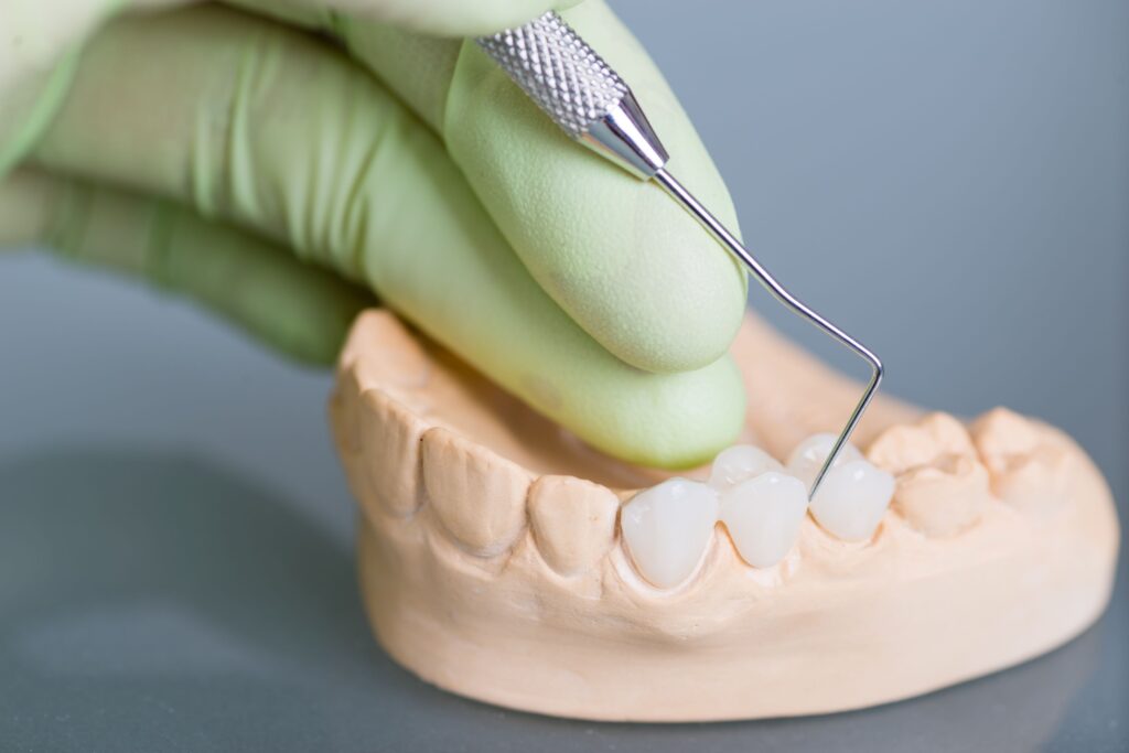 Dentist in green gloves placing bridge on model teeth