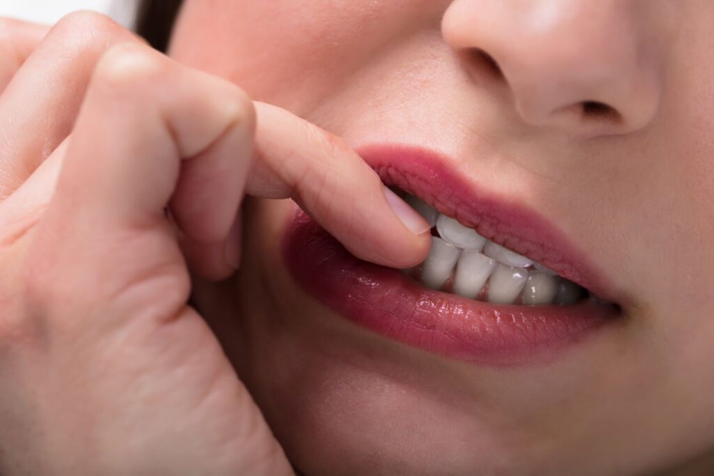 A woman biting her nails