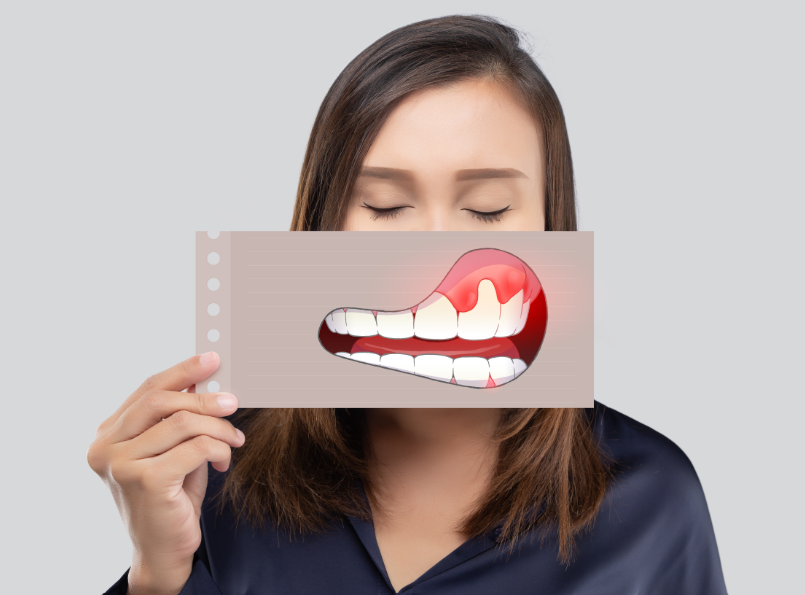Woman holding cartoon of inflamed gums over her mouth
