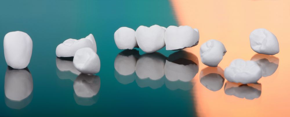 A variety of dental crowns and veneers